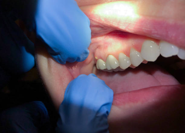Best Broken Tooth Emergency  in Hastings, PA